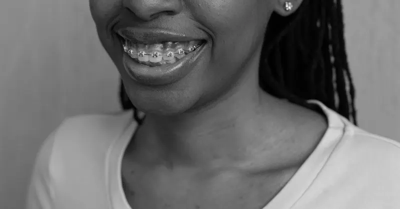 Smiling patient wearing orthodontic braces